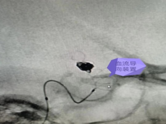 Snipaste_2023-08-01_09-22-39.jpg Snipaste_2023-08-01_09-22-39.jpg