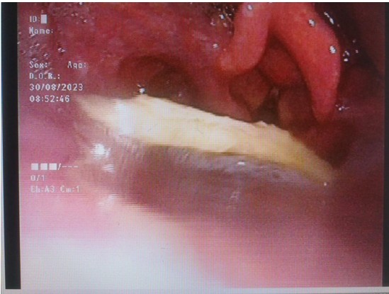 Snipaste_2023-09-03_09-42-45.jpg Snipaste_2023-09-03_09-42-45.jpg