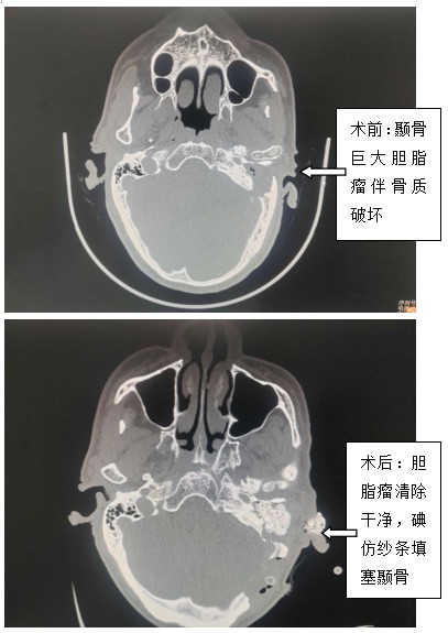Snipaste_2024-02-22_08-01-06.jpg Snipaste_2024-02-22_08-01-06.jpg