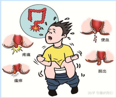 Snipaste_2024-04-12_16-20-05.jpg Snipaste_2024-04-12_16-20-05.jpg