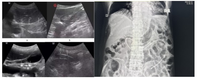 Snipaste_2024-05-30_15-10-14.jpg Snipaste_2024-05-30_15-10-14.jpg