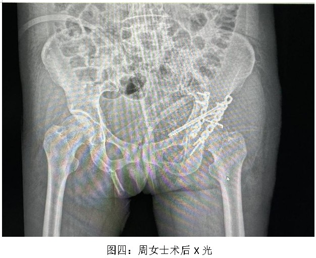 Snipaste_2024-09-19_14-34-32.jpg Snipaste_2024-09-19_14-34-32.jpg