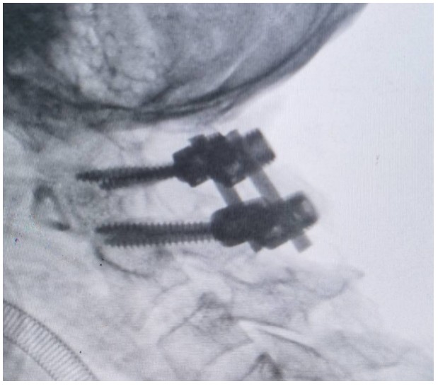 Snipaste_2024-10-15_08-28-35.jpg Snipaste_2024-10-15_08-28-35.jpg