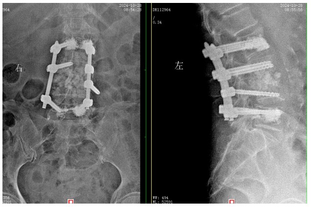 Snipaste_2024-11-07_11-46-16.jpg Snipaste_2024-11-07_11-46-16.jpg