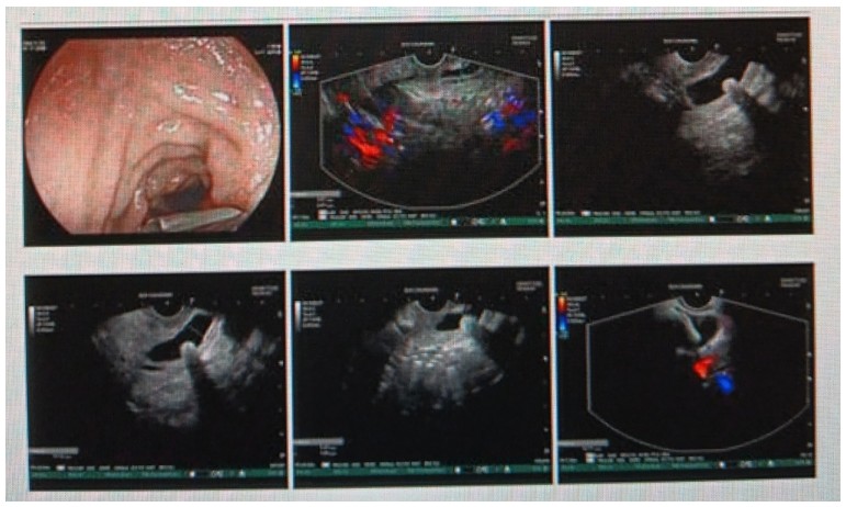 Snipaste_2025-05-16_15-50-52.jpg Snipaste_2025-05-16_15-50-52.jpg