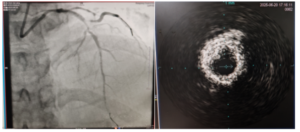 圖片11.png 圖片11.png